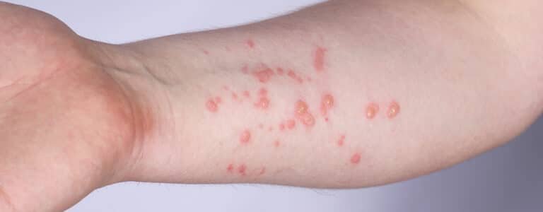 «Es importante que la gente sepa que existe»