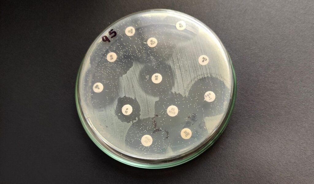 Confirman clon hipervirulento de una “Superbacteria” en Paraguay: esto recomiendan especialistas