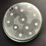 Confirman clon hipervirulento de una “Superbacteria” en Paraguay: esto recomiendan especialistas
